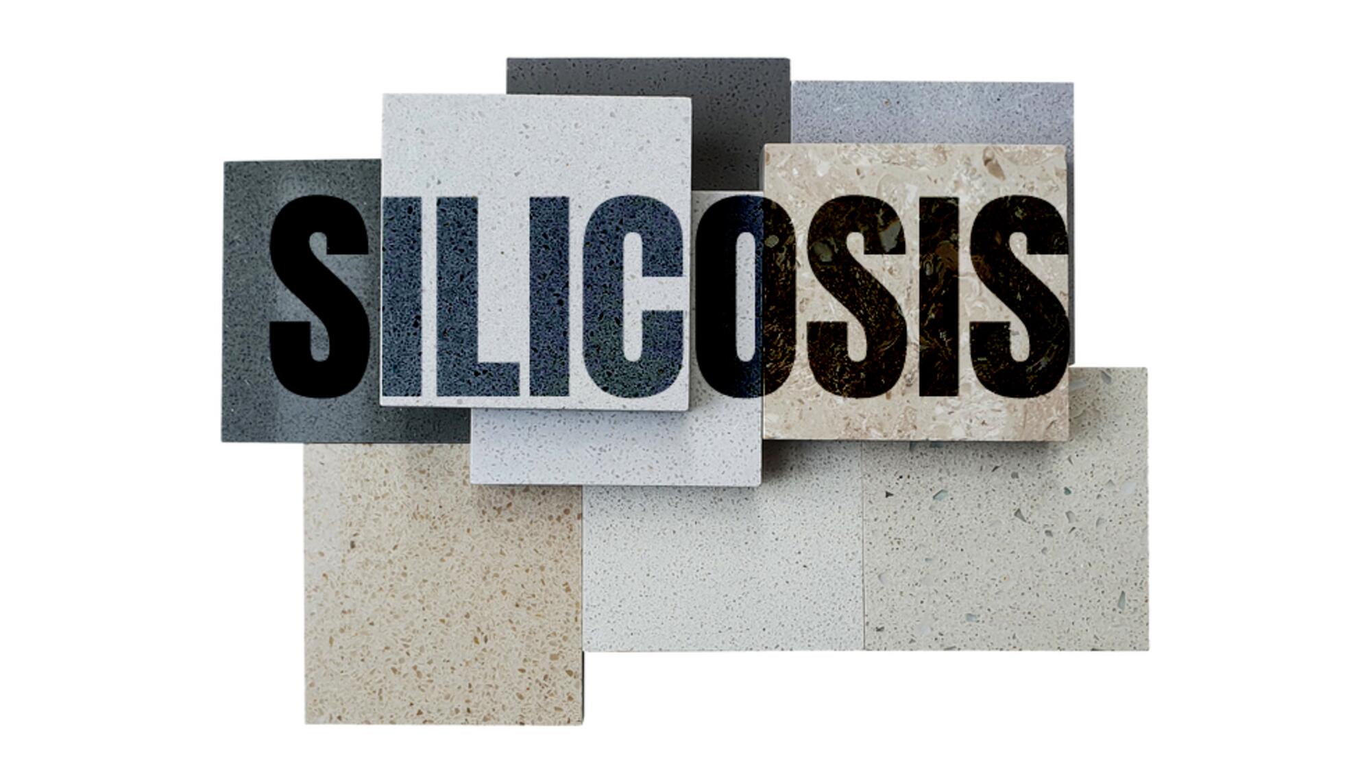 CRsilicosis