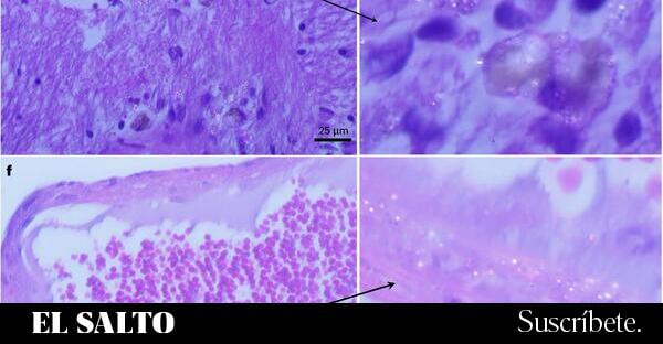 Un estudio de nanoplásticos en cerebros humanos detecta un aumento pronunciado en ocho años